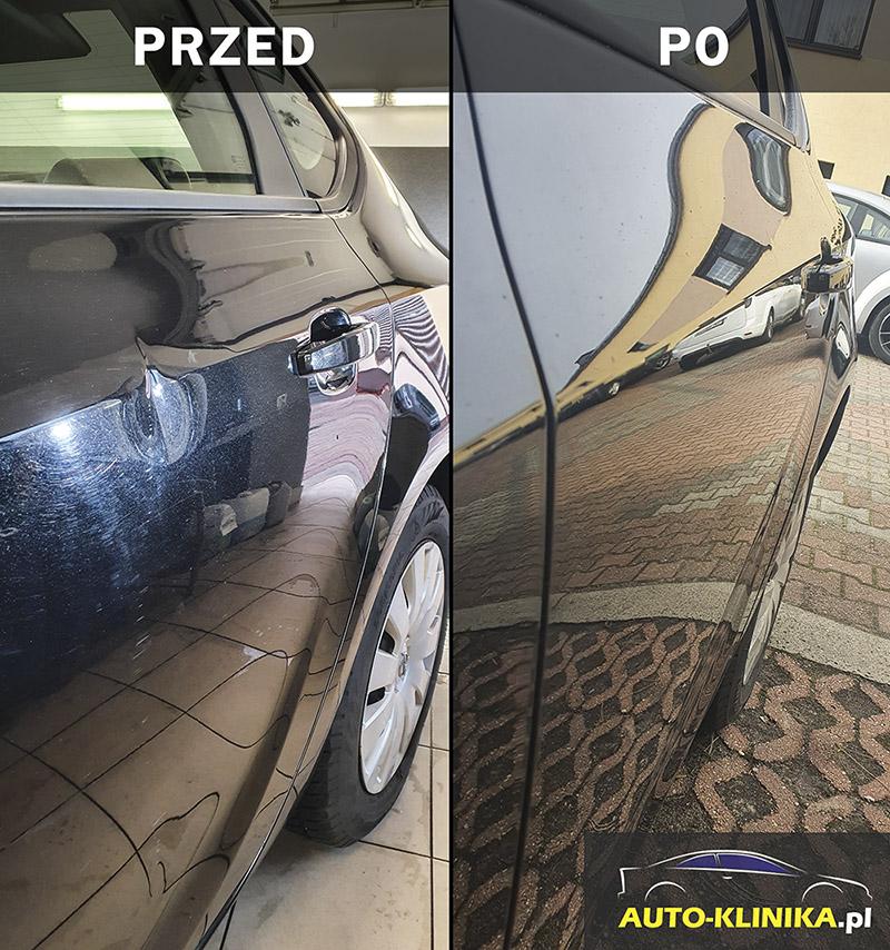 Domowe sposoby na wgniecenia